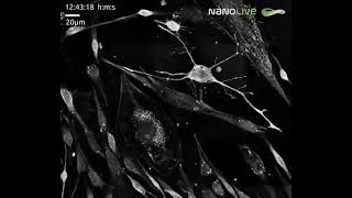 Birth of a brain cell - A stem cell becomes a neuron