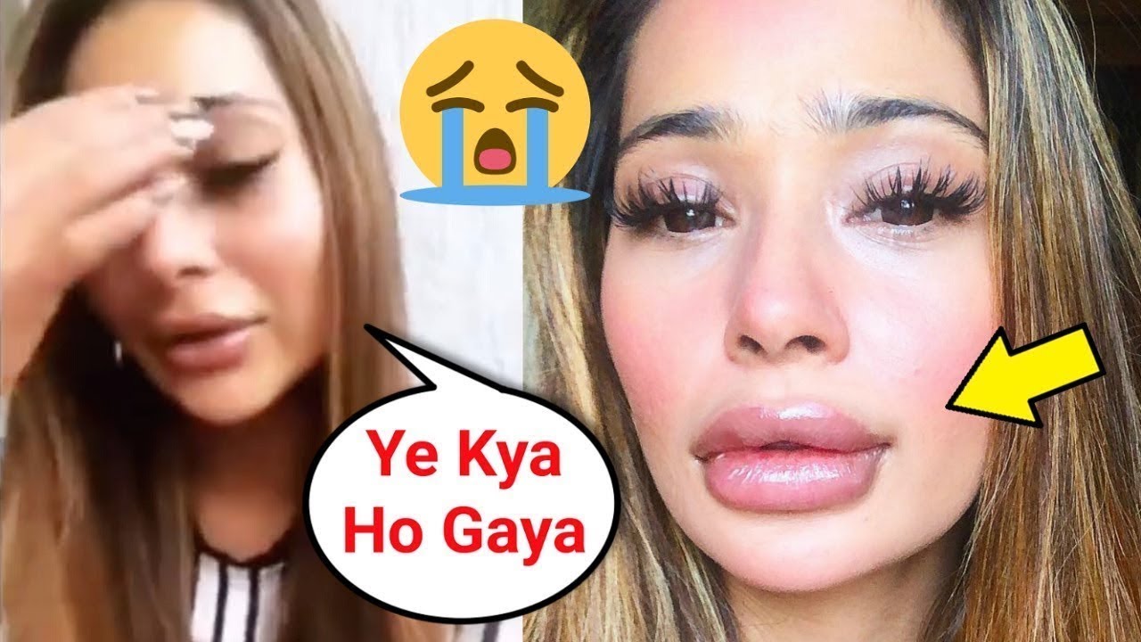 Sara Khan SH0CKING Reaction On Her Lip Job Gone Wrong YouTube