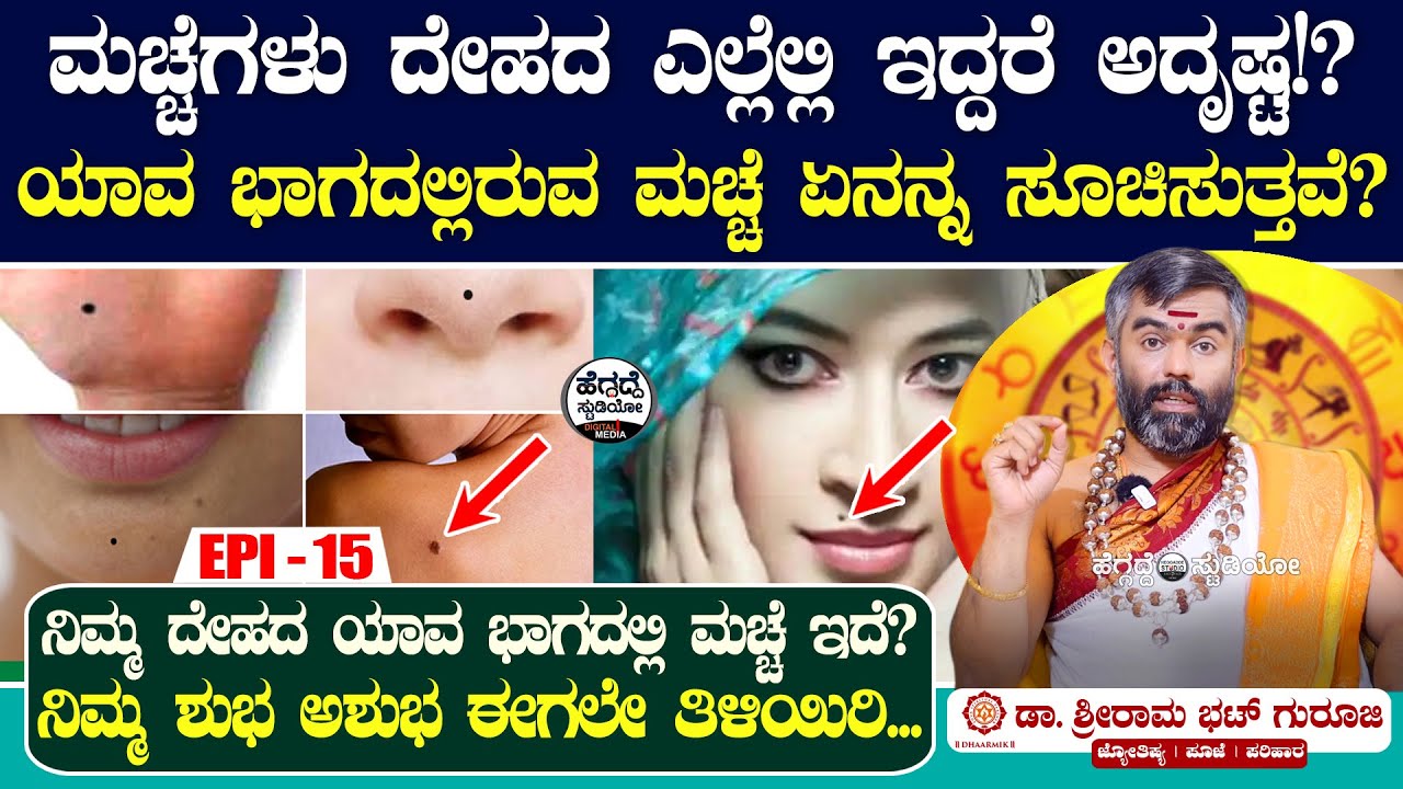 ನಿಮಗೆ ಮಚ್ಚೆಗಳಿವ್ಯಾ? ಮಚ್ಚೆಗಳು ದೇಹದ ಎಲ್ಲೆಲ್ಲಿ ಇದ್ದರೆ ಅದೃಷ್ಟ!? | Sriram Bhat Astrology Epi 15 #Heggadde