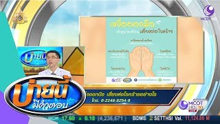 ภาวะเหงื่อออกมือ เสี่ยงต่อโรคร้ายอย่างไร (18 เม.ย.62) บ่ายนี้มีคำตอบ | 9 MCOT HD