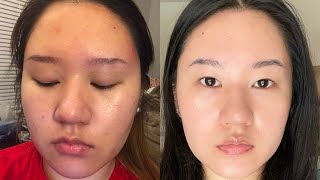 HOW I TRANSFORMED MY SKIN | 5 SIMPLE TIPS by Kelsey 81 views 2 years ago 6 minutes, 17 seconds