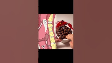 Why Your Stomach Must Stay Empty Before Surgery#animation #funny #shorts