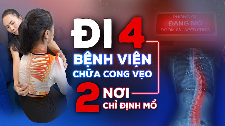 Phẫu thuật vẹo cột sống bao nhiêu tiền năm 2024