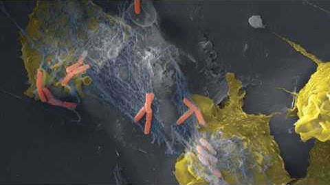 Neutrophil Extracellular Traps