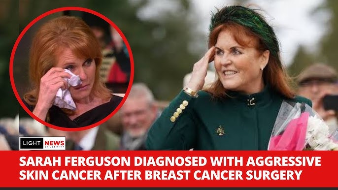 Omg Sarah Ferguson Duchess Of York Diagnosed With Malignant Melanoma After Battling Breast Cancer