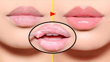 How do you get Noce lips?