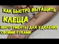 Как быстро вытащить клеща и инструменты для удаления клеща своими руками