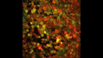Multi-modal microscopy of liver (SHG, eRFP and eYFP)