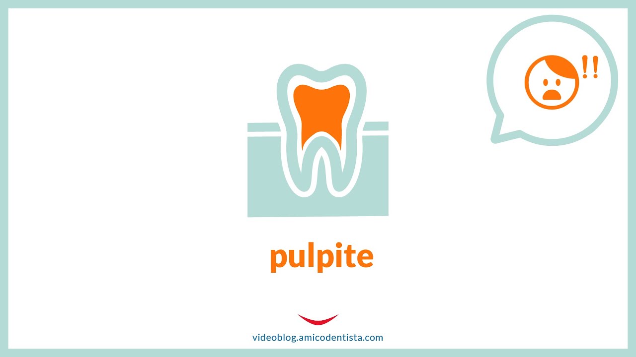 Pulpite: cos'è, quali sono i sintomi, le cause e le terapie?