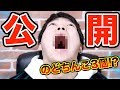 【閲覧注意】ずっと隠していた口の中を公開します...