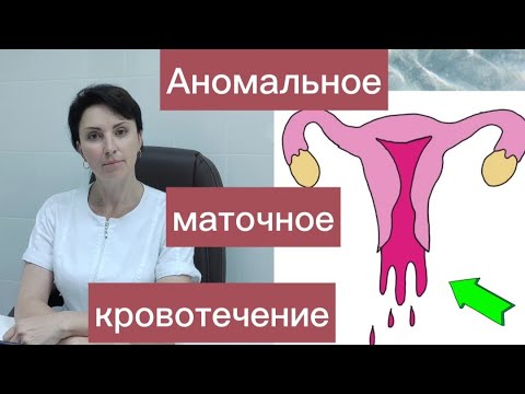 Аномальные маточные кровотечения. Причины и тактика лечения.