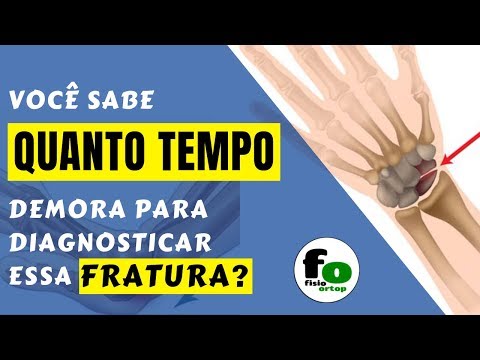 Vídeo: Fratura Navicular No Pé E No Pulso