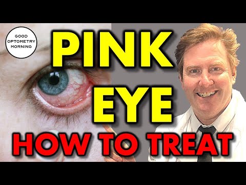 WHAT CAUSES PINK EYE u0026 HOW TO TREAT PINK EYE: youtube eye doctor explains conjunctivitis