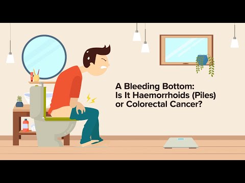 The Bleeding Bottom: Is It Piles or Colorectal Cancer?