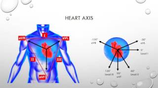 12 Lead ECG Episode 4 - Heart Axis