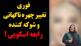 فوری : تغییر چهره ناگهانی و شوکه کننده رابعه اسکویی !