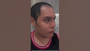 Serum kích thích Mọc Tóc, lấp đầy mảng hói, tóc rụng nhiều - Abera Men