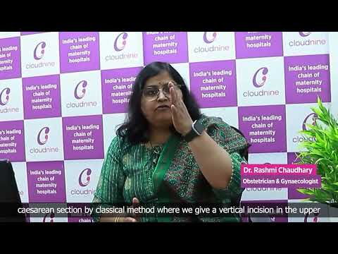 Vaginal Birth After Caesarean Section | Dr Rashmi Chaudhary | Cloudnine Hospital, Bellandur