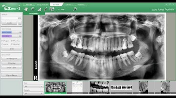 EZDent i, Chapter 01 03   Patient and Image List FINAL