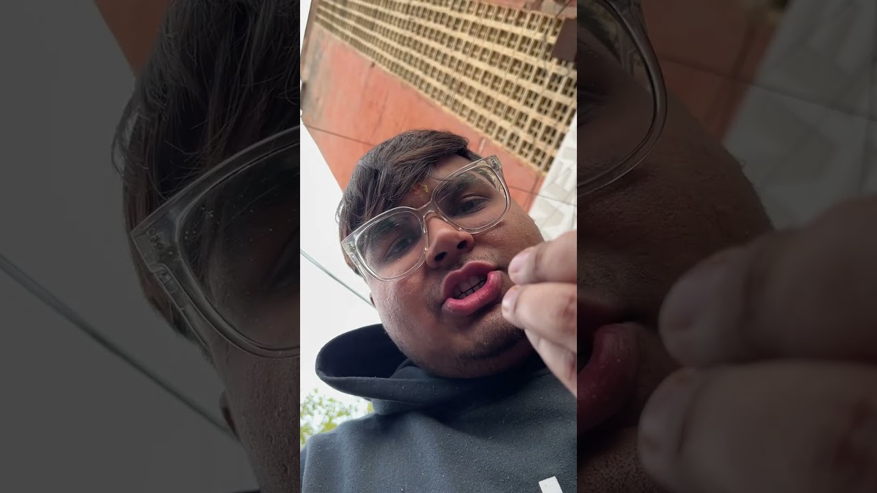 Orry Phone Cover📱😲 