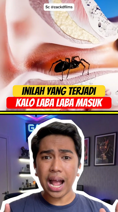 This is what happens when a spider enters your ear, guys #feedshorts #shortsviral #shortvideo