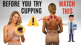 Doctor SHOCKED by ROBO Cupping Therapy Device - IS IT SAFE? screenshot 2