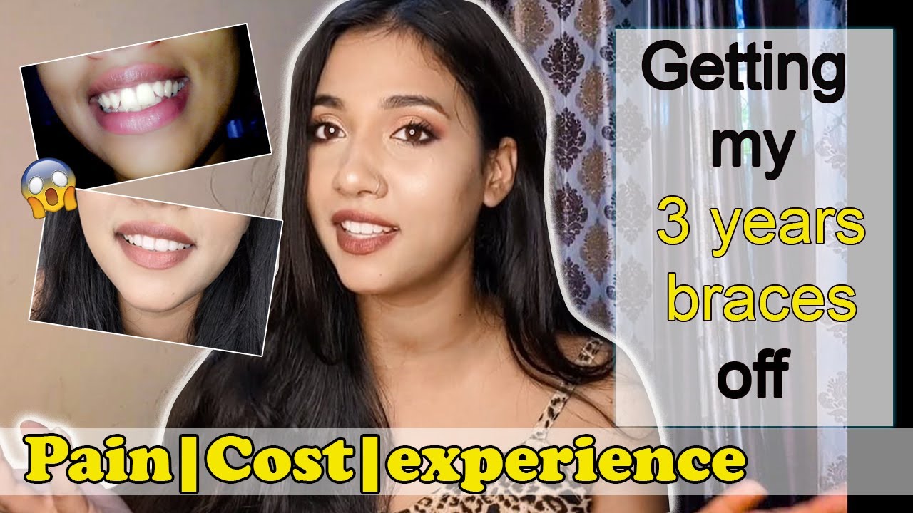 MY BRACES JOURNEY metal braces 3 YEARS BRACES COST YouTube
