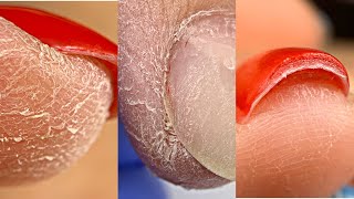 ПАЛЬЦЫ СУХАРИ Маникюр на клиенте Комбинированный маникюр