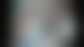 UNEDITED - PHACOEMULSIFICATION - Dr. Saurav Piya