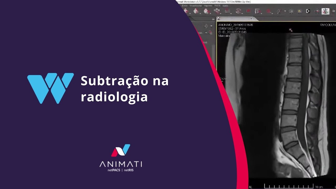 Animati Workstation - Subtração