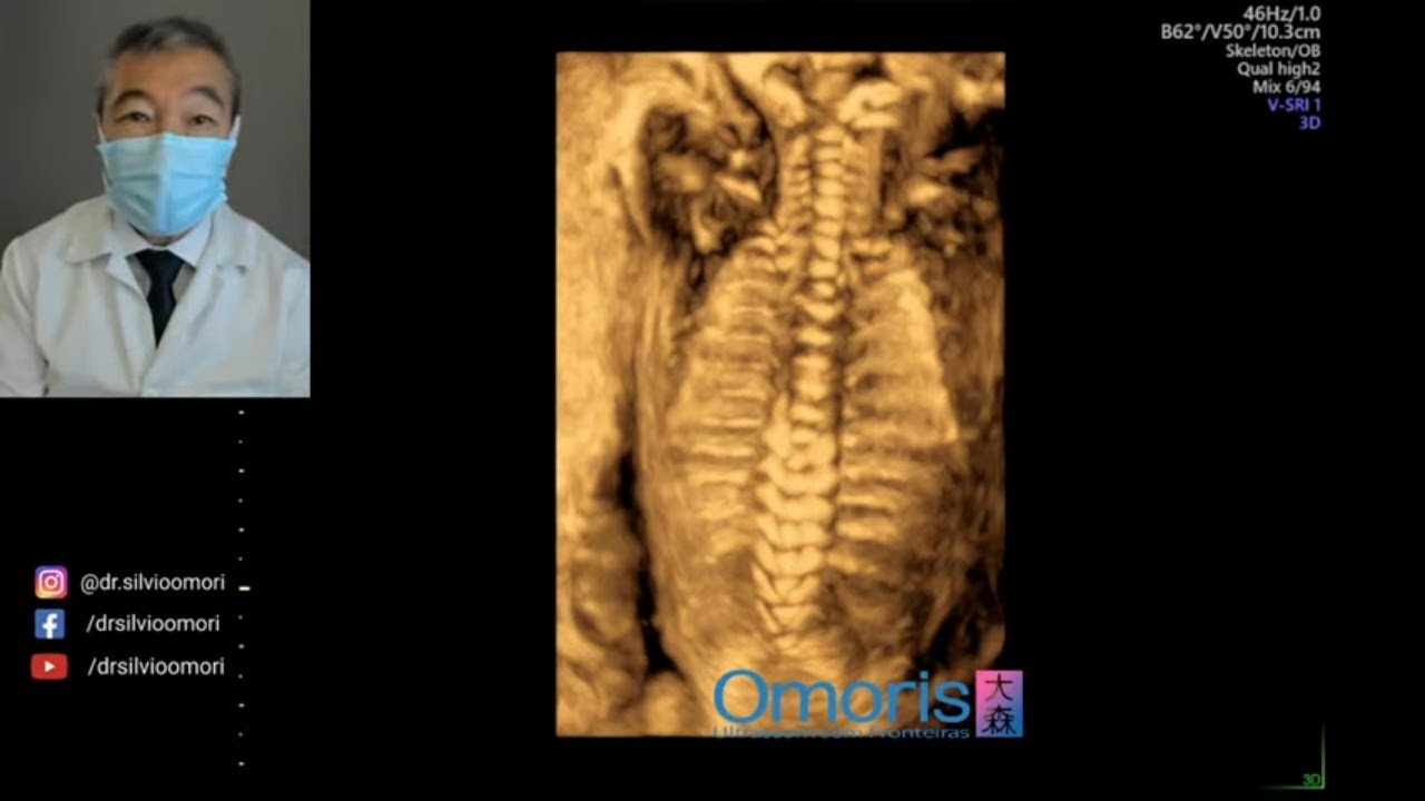 УЗИ - 24 недели