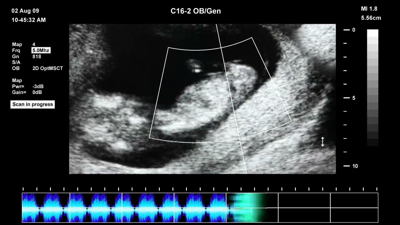 Jak vypadají první pohyby plodu v těhotenství?