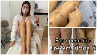 PÓS-OPERATÓRIO LIPEDEMA - Parte 2 