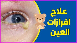 علاج انسداد القنوات الدمعية وعلاج افرازات العين عند الاطفال والرضع   (شوفوا الفيديو للاخر)