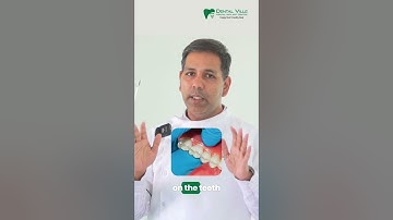 Invisible Aligners or Conventional Braces - Myth Busted Dr Ashwin Kumar Dental Ville