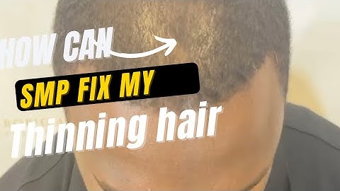 Adding Density with SMP