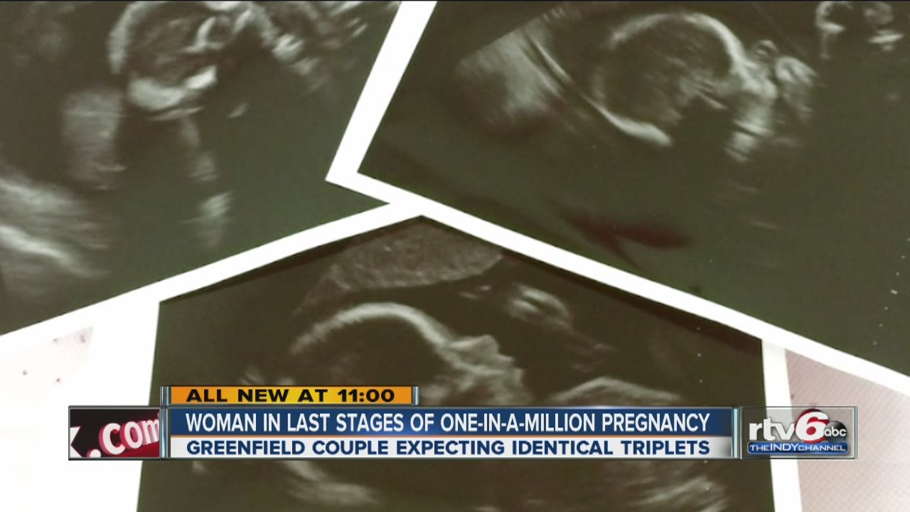 Couple prepares for rare identical triplets YouTube