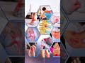 Come to Legend Physiotherapy Ortho and Neuro Pain Management Clinic in Kothapet and LB Nagar