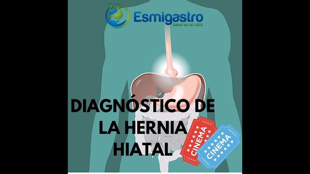 Diagnóstico de la Hernia Hiatal saludos amigos dvd