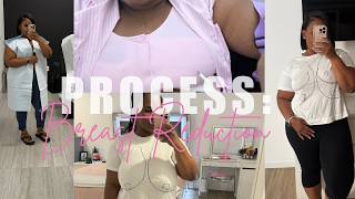 How I paid $300 for my breast reduction surgery