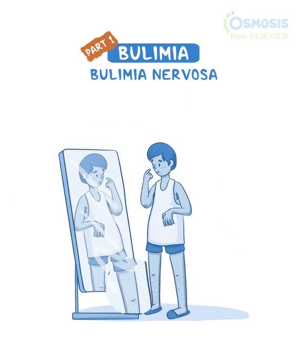 Bulimia Nervosa