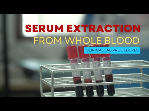 Video: 3 būdai, kaip patikrinti kraujo serumą