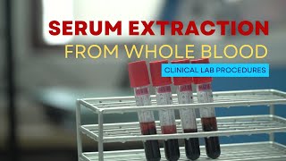 Serum Extraction from Whole Blood