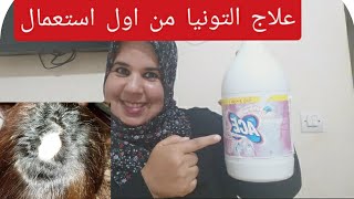 القضاء نهاءيا على داء الثعلبة التونيا/من اول إستعمال/مشترياتي لوليداتي ب5دراهم.