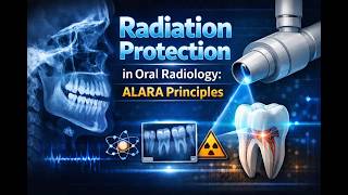 Radiation Protection in Oral Radiology ALARA Principles,  for Dental Exams