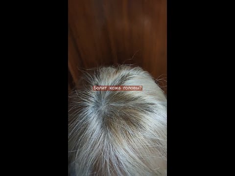 Болит кожа головы - только так спасаюсь 🤩
