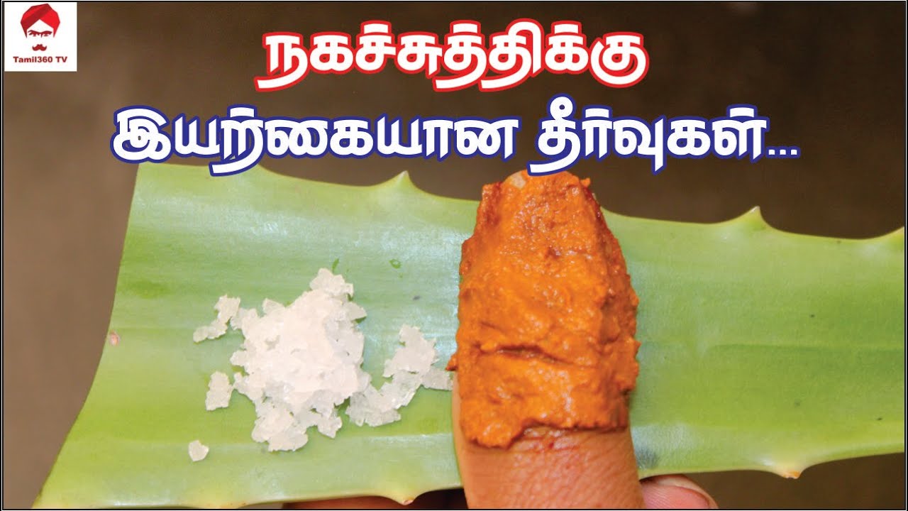 Nailfungus நகசுத்திக்கு இயற்கையான தீர்வுகள் How to Cure Nail Fungus