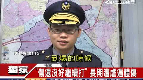 5岁女童疑遭父虐打　双腿瘀青红肿│三立新闻台 - 天天要闻