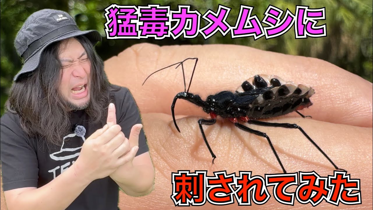 Extreme pain! Extreme itching! I was stung by an invasive species