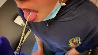 💉💉 ZUNGENPIERCING STECHEN IM ROYAL SKIN PIERCINGSTUDIO BERLIN💉💉